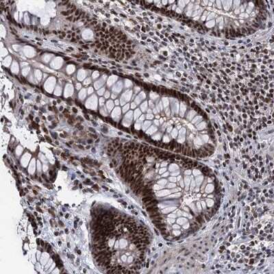 Immunohistochemistry-Paraffin: ZCCHC10 Antibody [NBP1-82206]