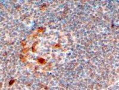 Immunohistochemistry-Paraffin: ZCCHC11/TUT4 Antibody [NB100-783]