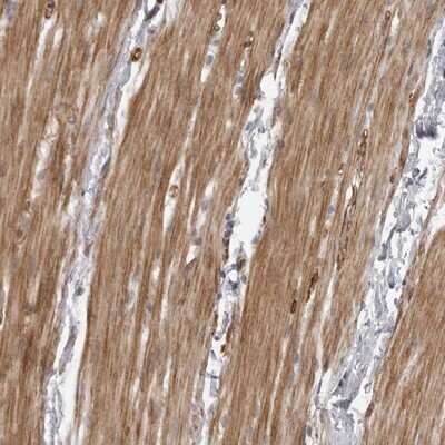 Immunohistochemistry-Paraffin: ZCCHC11/TUT4 Antibody [NBP1-83027]