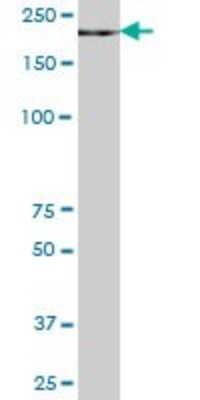 Western Blot: ZCCHC11/TUT4 Antibody [H00023318-B01P]