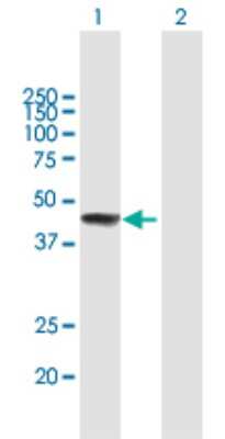 Western Blot: ZCCHC11/TUT4 Antibody [H00023318-B01P]