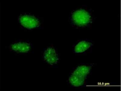 Immunocytochemistry/ Immunofluorescence: ZCCHC13 Antibody [H00389874-B01P]