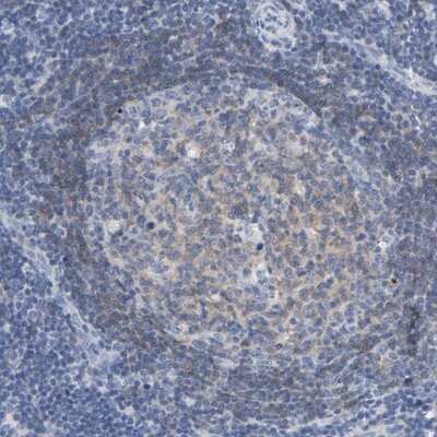 Immunohistochemistry-Paraffin: ZCCHC13 Antibody [NBP1-92604]