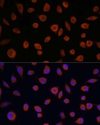 Immunocytochemistry/ Immunofluorescence: ZCCHC3 Antibody - Azide and BSA Free [NBP2-94056]