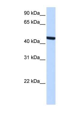 Western Blot: ZCCHC3 Antibody [NBP1-79404]
