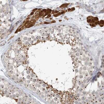 Immunohistochemistry-Paraffin: ZCCHC4 Antibody [NBP2-38258]