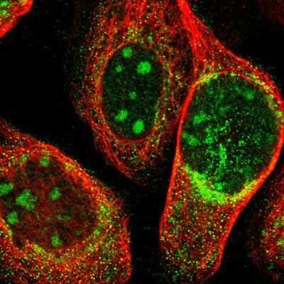 Immunocytochemistry/ Immunofluorescence: ZCCHC7 Antibody [NBP1-89176]