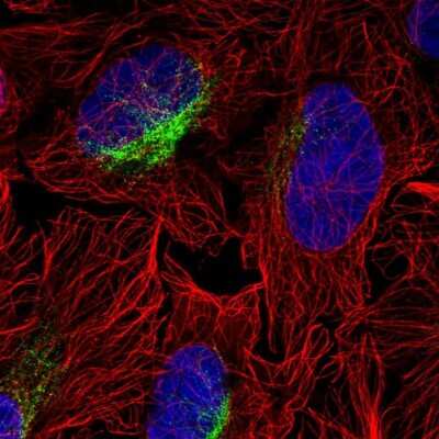 Immunocytochemistry/ Immunofluorescence: ZCCHC9 Antibody [NBP2-57147]