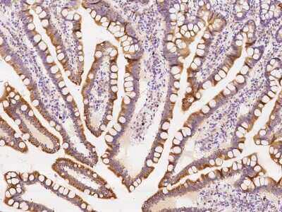 Immunohistochemistry-Paraffin: ZCCHC9 Antibody [NBP2-97817]