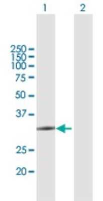 Western Blot: ZCCHC9 Antibody [H00084240-B01P]