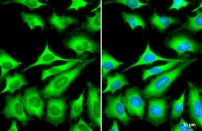 Immunocytochemistry/ Immunofluorescence: ZCCHV Antibody [NBP2-20940]