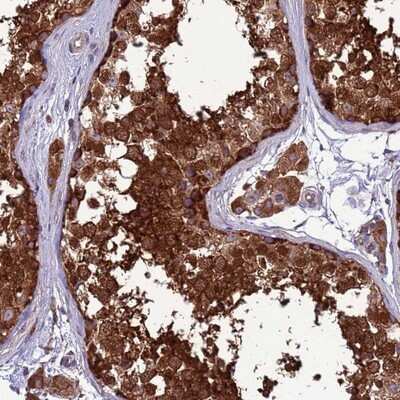 Immunohistochemistry-Paraffin: ZCCHV Antibody [NBP1-92607]