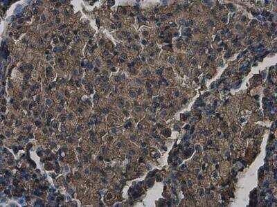 Immunohistochemistry-Paraffin: ZCCHV Antibody [NBP2-20940]