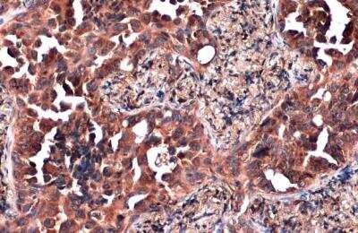 Immunohistochemistry-Paraffin: ZCCHV Antibody [NBP2-20940]