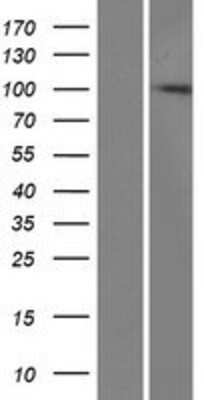 Western Blot: ZCCHV Overexpression Lysate [NBP2-06692]
