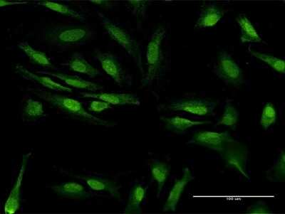 Immunocytochemistry/ Immunofluorescence: ZCRB1 Antibody [H00085437-B01P]