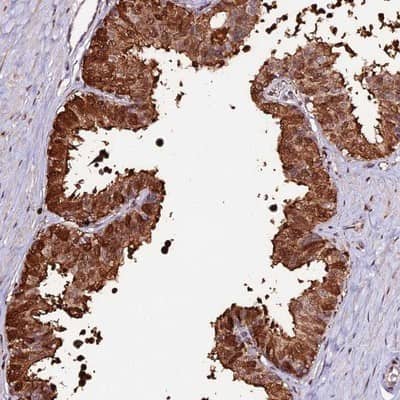 Immunohistochemistry-Paraffin: ZDBF2 Antibody [NBP2-14501]