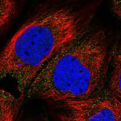Immunocytochemistry/ Immunofluorescence: ZDHHC1 Antibody [NBP2-13539]