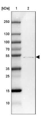 Western Blot: ZDHHC1 Antibody [NBP2-13539]