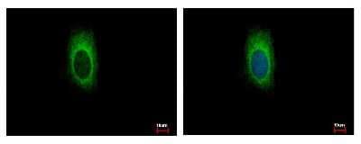 Immunocytochemistry/ Immunofluorescence: ZDHHC13 Antibody [NBP1-31024]
