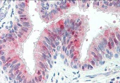 Immunohistochemistry-Paraffin: ZDHHC13 Antibody [NBP1-51920]
