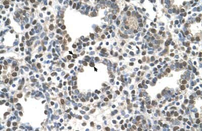 Immunohistochemistry-Paraffin: ZDHHC13 Antibody [NBP1-59026]