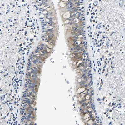 Immunohistochemistry-Paraffin: ZDHHC13 Antibody [NBP1-83822]
