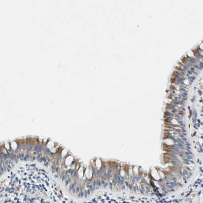 Immunohistochemistry-Paraffin: ZDHHC13 Antibody [NBP1-83823]