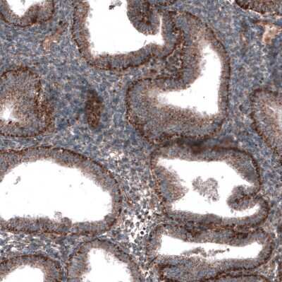 Immunohistochemistry-Paraffin: ZDHHC14 Antibody [NBP1-92608]