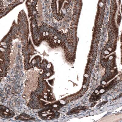 Immunohistochemistry-Paraffin: ZDHHC14 Antibody [NBP1-92608]