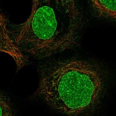 Immunocytochemistry/ Immunofluorescence: ZDHHC16 Antibody [NBP2-55212]