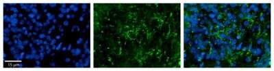 Immunohistochemistry: ZDHHC17 Antibody [NBP1-59039]
