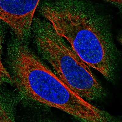 Immunocytochemistry/ Immunofluorescence: ZDHHC22 Antibody [NBP2-58832]
