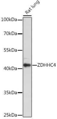 Western Blot: ZDHHC4 AntibodyAzide and BSA Free [NBP2-94486]