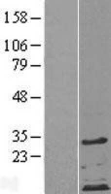 Western Blot: ZDHHC4 Overexpression Lysate [NBP2-09538]