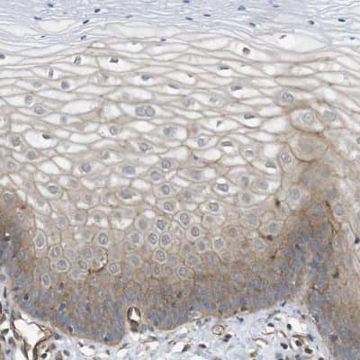 Immunohistochemistry-Paraffin: ZDHHC5 Antibody [NBP1-81376]