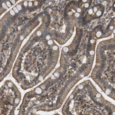 Immunohistochemistry-Paraffin: ZDHHC5 Antibody [NBP1-81376]