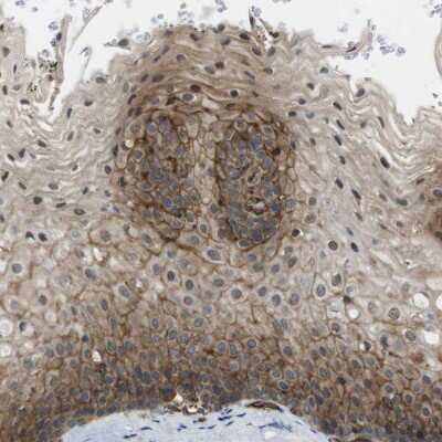 Immunohistochemistry-Paraffin: ZDHHC5 Antibody [NBP1-81376]