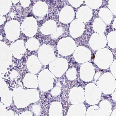 Immunohistochemistry: ZDHHC7 Antibody [NBP2-33884]