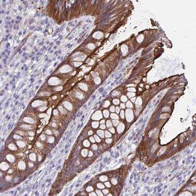 Immunohistochemistry-Paraffin: ZDHHC7 Antibody [NBP2-32486]