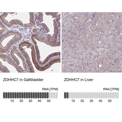 Immunohistochemistry-Paraffin: ZDHHC7 Antibody [NBP2-32486]