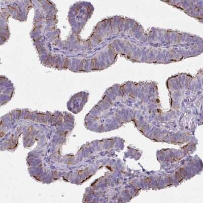 Immunohistochemistry-Paraffin: ZDHHC7 Antibody [NBP2-32486]