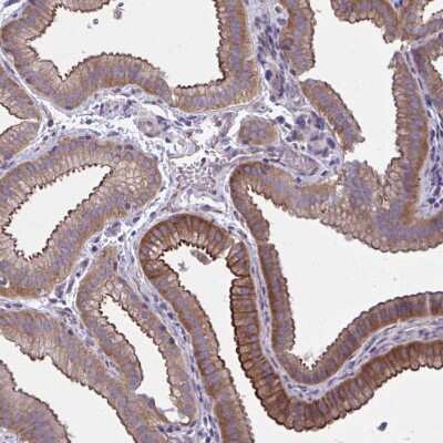 Immunohistochemistry-Paraffin: ZDHHC7 Antibody [NBP2-32486]