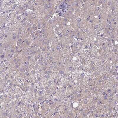 Immunohistochemistry-Paraffin: ZDHHC7 Antibody [NBP2-32486]