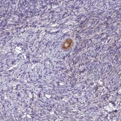 Immunohistochemistry-Paraffin: ZDHHC7 Antibody [NBP2-32486]