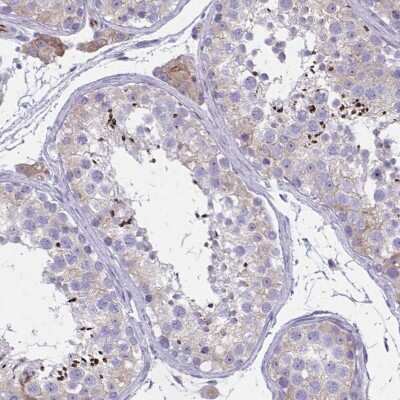 Immunohistochemistry-Paraffin: ZDHHC7 Antibody [NBP2-32486]