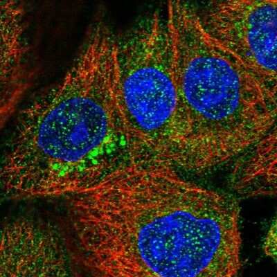 Immunocytochemistry/ Immunofluorescence: ZDHHC9 Antibody [NBP1-84499]