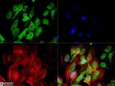 Immunocytochemistry/ Immunofluorescence: ZEB1 Antibody (2A8A6) - Azide and BSA Free [NBP2-81015]