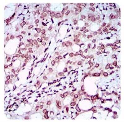 Immunohistochemistry: ZEB1 Antibody (2A8A6) - Azide and BSA Free [NBP2-81015]