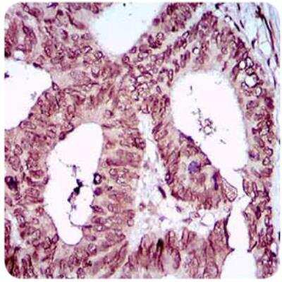 Immunohistochemistry: ZEB1 Antibody (2A8A6) - BSA Free [NBP2-23484]